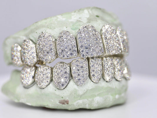 Custom Moissanite Grillz