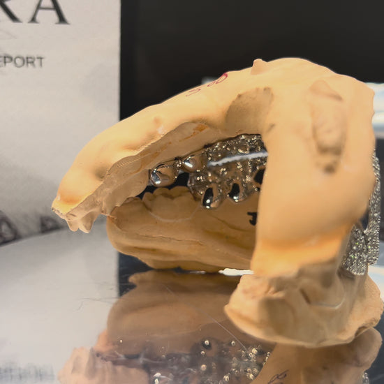 Custom Moissanite Bust Down Diamond Grill by JJ’s Grillz UK