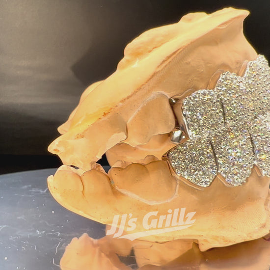Moissanite Grillz Custom Diamond Grillz Luxury VVS Grillz Handcrafted Grillz - Worldwide Shipping