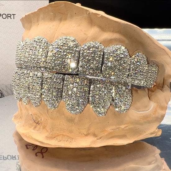 Moissanite Grillz Custom Diamond Grillz Luxury VVS Grillz Handcrafted Grillz - Worldwide Shipping