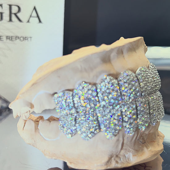 High Quality Moissanite Grillz Made & Displayed by JJ's Grillz.
